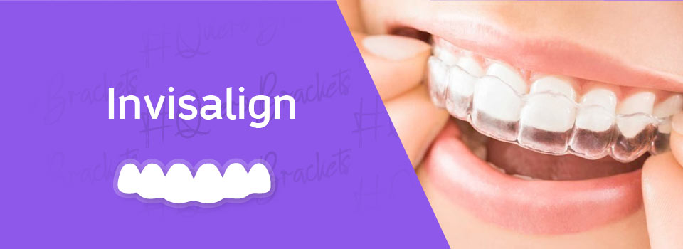 Invisalign alindeadores dentales