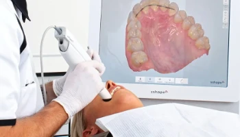 Diseño de sonrisa